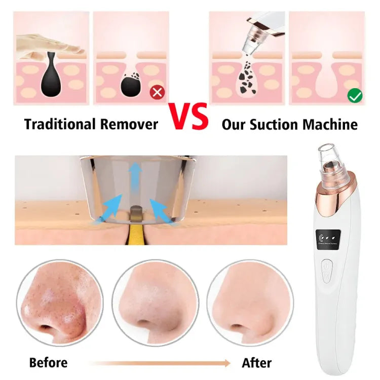 Original 5 in 1 Electric Blackhead Remover Machine Rechargeable Done Extractor Face Rechargeable