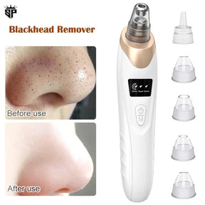 Original 5 in 1 Electric Blackhead Remover Machine Rechargeable Done Extractor Face Rechargeable